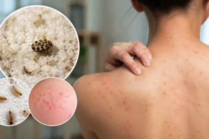 Carpet Beetle Rash Signs You Should Treat Today
